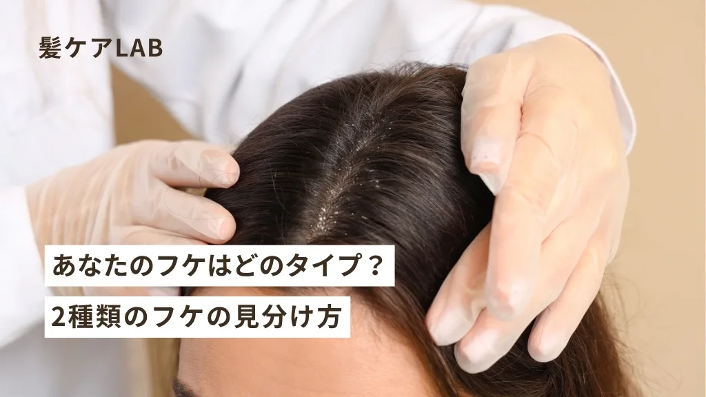 頭皮のフケと乾燥！原因と対策